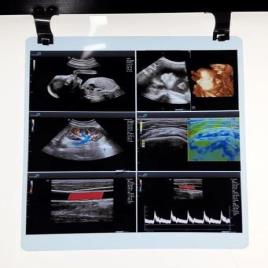 Inkjet PET Film - Blue