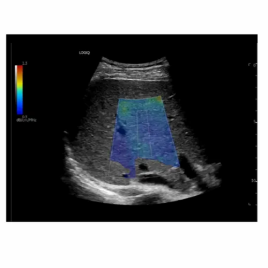 Logiq-E10 Ultrasound Machine Series