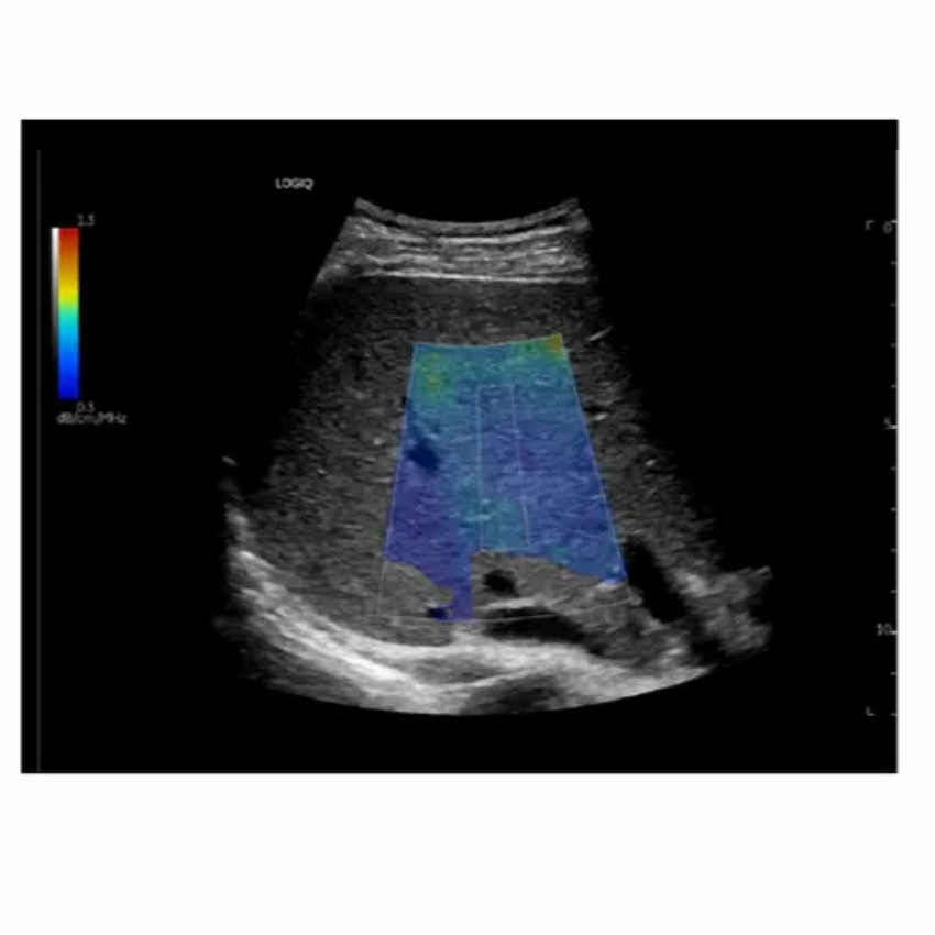 Logiq-E10 Ultrasound Machine Series