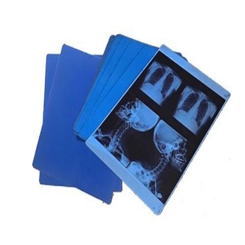 Mindware Blue X-ray Film
