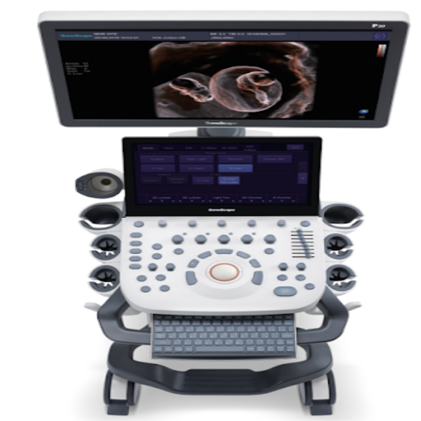 SonoScape P20 Color Doppler Ultrasound Machine