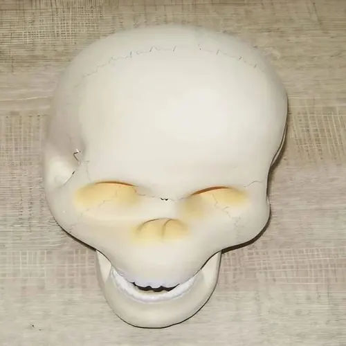Fetal Skull Anatomical Model